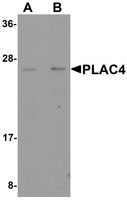 1 - PLAC4 Antibody ASC11222