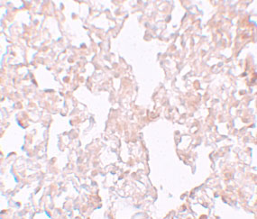2 - MFSD1 Antibody ASC11223