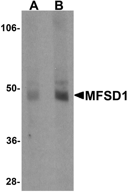 1 - MFSD1 Antibody ASC11223