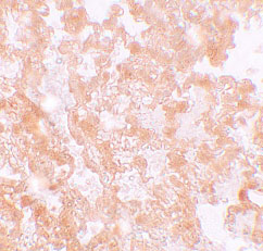 2 - MFSD2A Antibody ASC11224