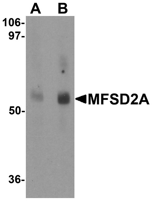 1 - MFSD2A Antibody ASC11224