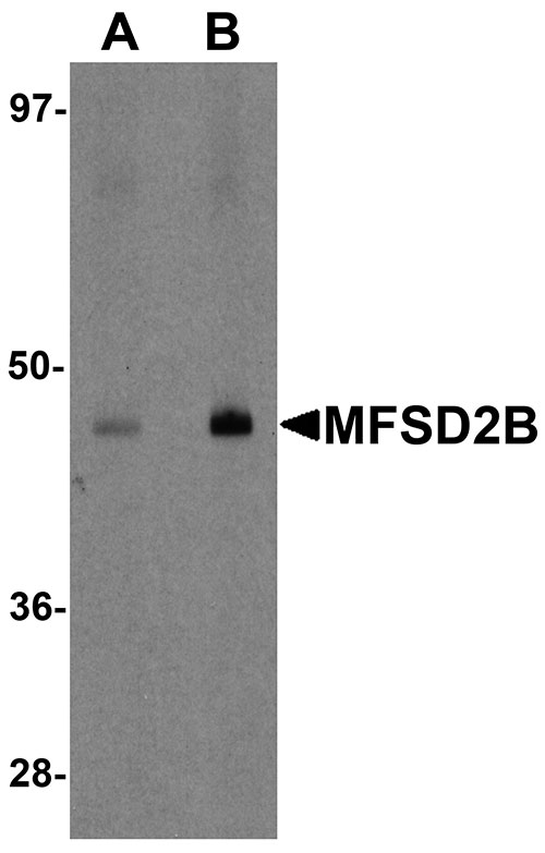 1 - MFSD2B Antibody ASC11225