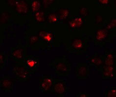3 - PIWI-L3 Antibody ASC11228