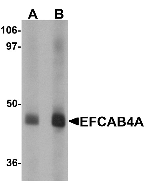 1 - EFCAB4A Antibody ASC11231
