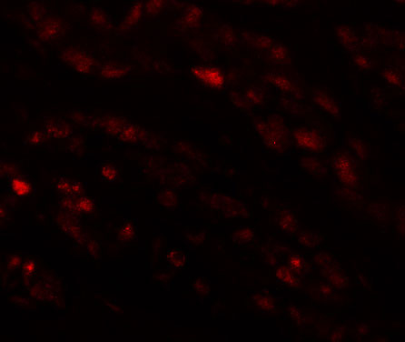 3 - EFCAB4B Antibody ASC11232