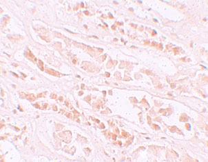2 - EFCAB4B Antibody ASC11232