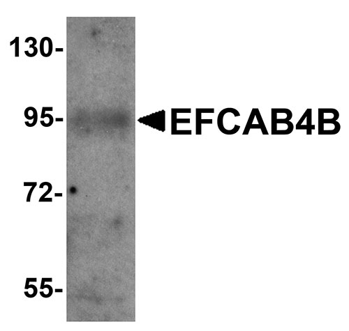 1 - EFCAB4B Antibody ASC11232