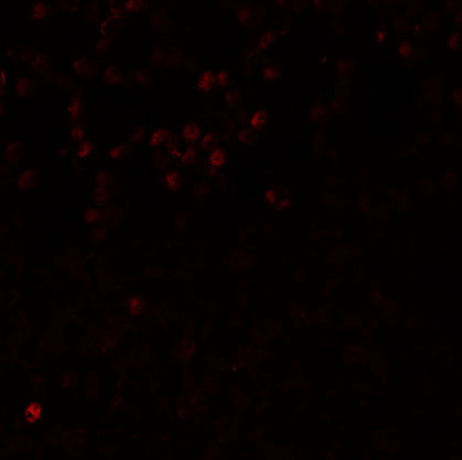 3 - LMBRD1 Antibody ASC11233