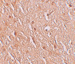2 - LMBRD1 Antibody ASC11233