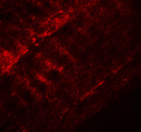 3 - SYNPO2 Antibody ASC11235
