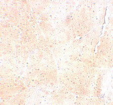 2 - SYNPO2 Antibody ASC11235