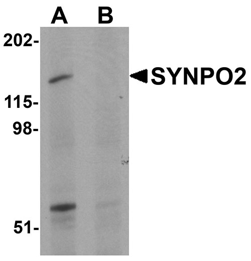 1 - SYNPO2 Antibody ASC11235