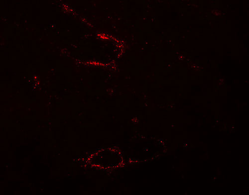 3 - SYNPO2L Antibody ASC11236