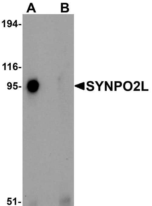 1 - SYNPO2L Antibody ASC11236