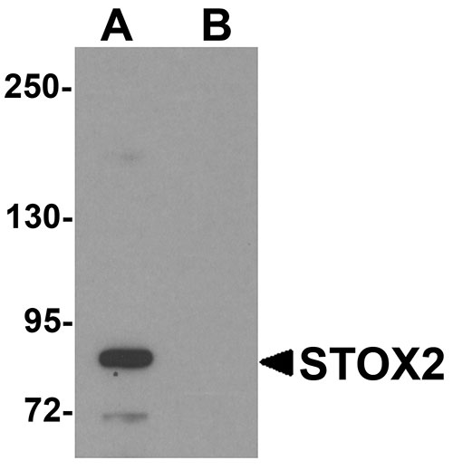 1 - STOX2 Antibody ASC11239
