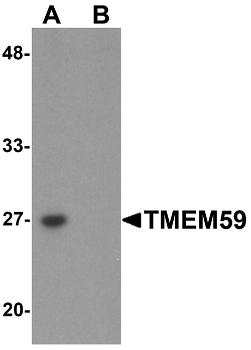 1 - TMEM59 Antibody ASC11240