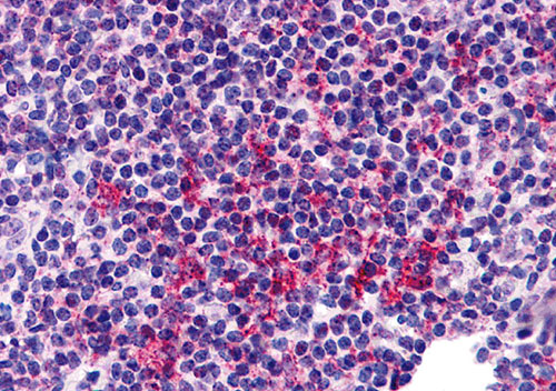 2 - ZNF687 Antibody ASC11242