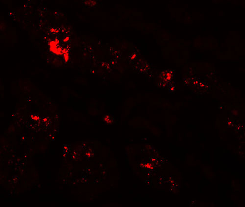 3 - ZIP1 Antibody ASC11243
