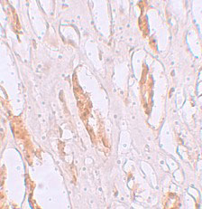 2 - ZIP1 Antibody ASC11243