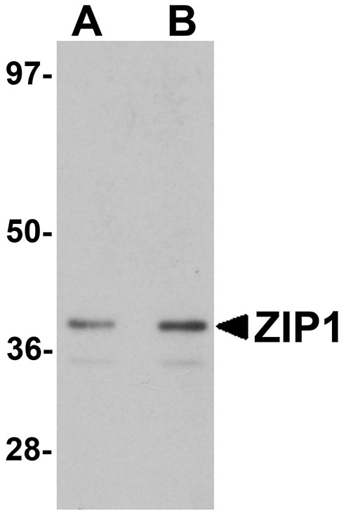 1 - ZIP1 Antibody ASC11243