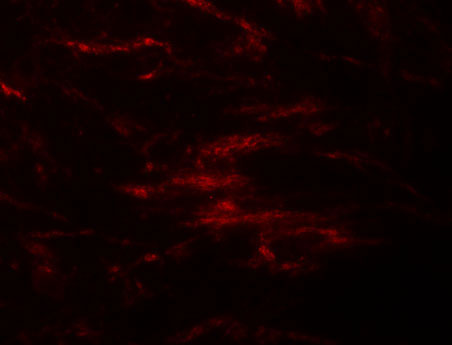 3 - ZIP2 Antibody ASC11244