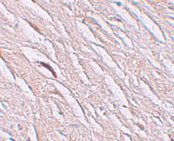 2 - ZIP2 Antibody ASC11244
