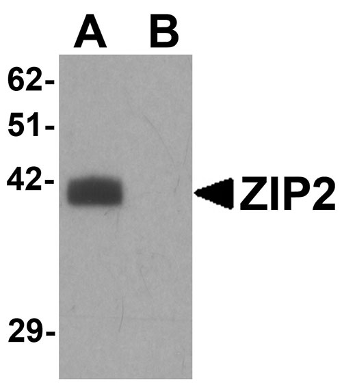 1 - ZIP2 Antibody ASC11244