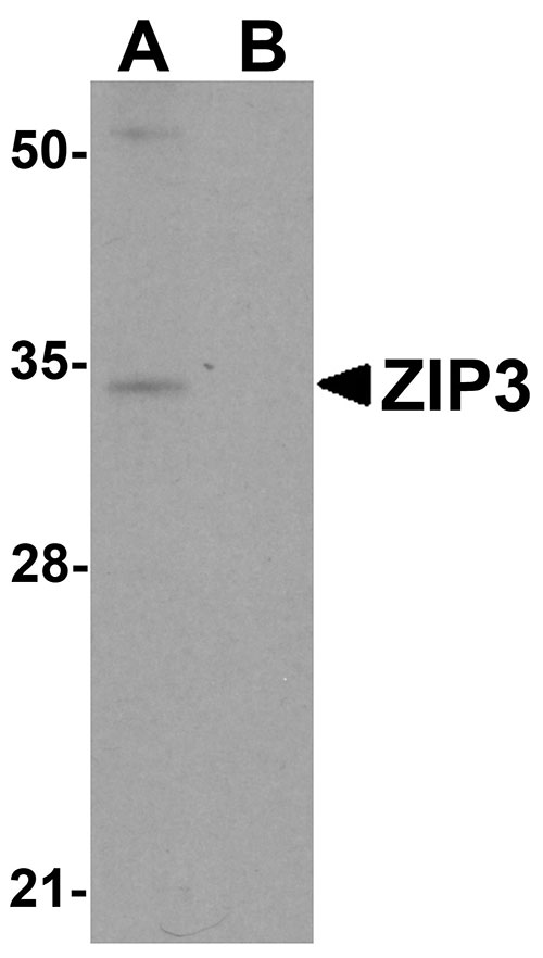 1 - ZIP3 Antibody ASC11245