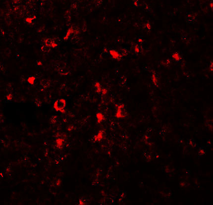 3 - ZIP5 Antibody ASC11246