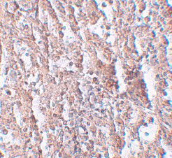 2 - ZIP5 Antibody ASC11246