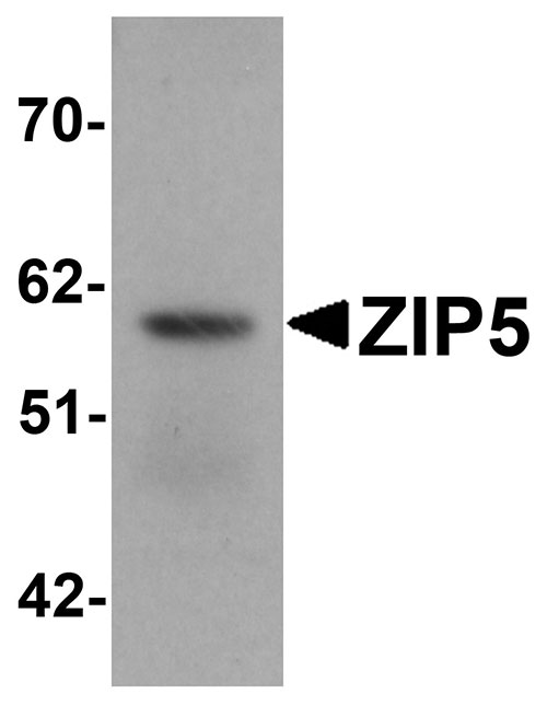 1 - ZIP5 Antibody ASC11246