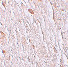 2 - ZIP7 Antibody ASC11248