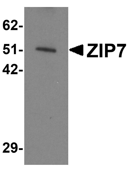 1 - ZIP7 Antibody ASC11248