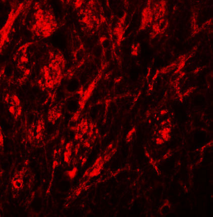 3 - ZIP9 Antibody ASC11250