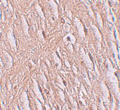 2 - ZIP9 Antibody ASC11250