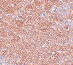 2 - ZIP12 Antibody ASC11252