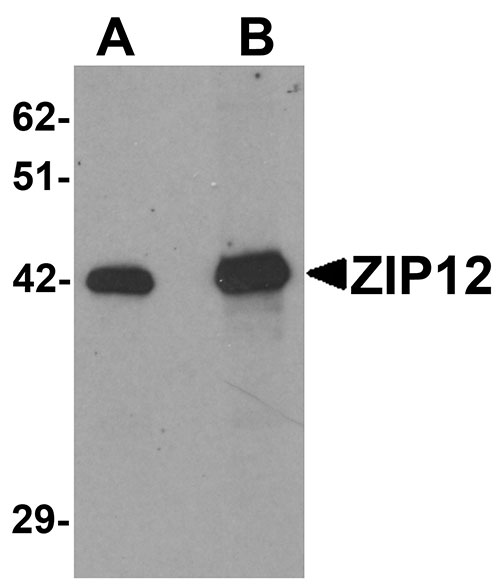 1 - ZIP12 Antibody ASC11252