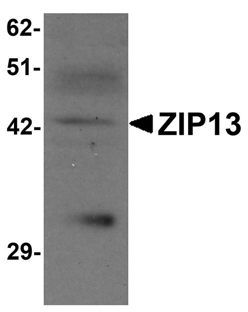 1 - ZIP13 Antibody ASC11253