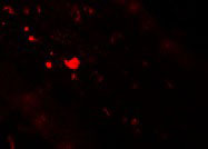 3 - TFF3 Antibody ASC11258