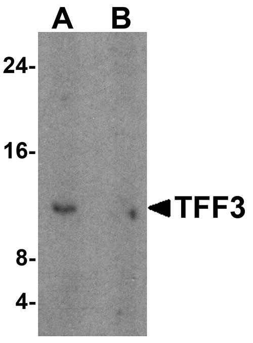 1 - TFF3 Antibody ASC11258