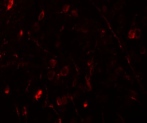 3 - WIZ Antibody ASC11259
