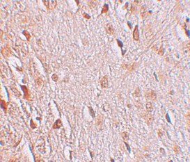 2 - WIZ Antibody ASC11259