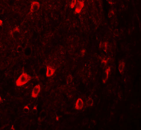 3 - ZBTB3 Antibody ASC11260