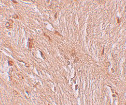 2 - ZBTB3 Antibody ASC11260