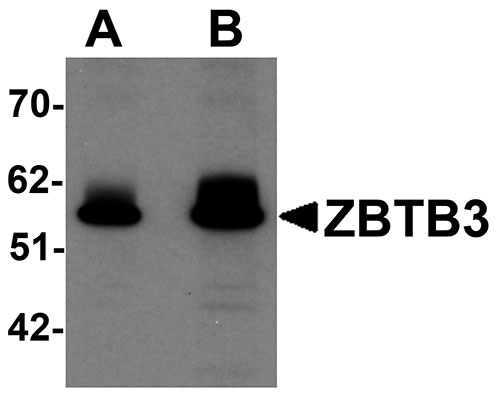 1 - ZBTB3 Antibody ASC11260