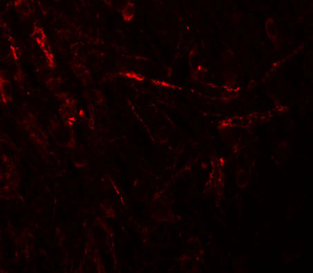 3 - ZBTB4 Antibody ASC11261