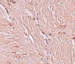 2 - ZBTB4 Antibody ASC11261