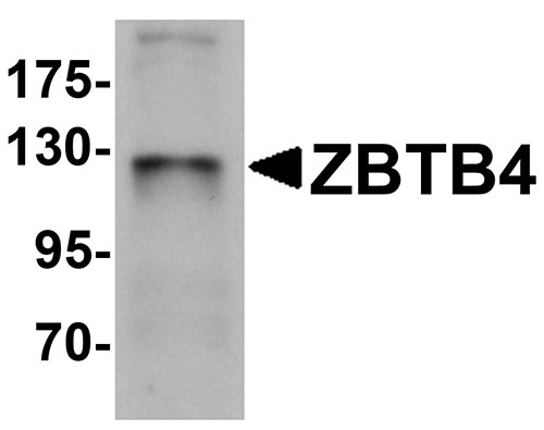 1 - ZBTB4 Antibody ASC11261