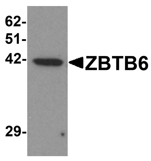 1 - ZBTB6 Antibody ASC11263