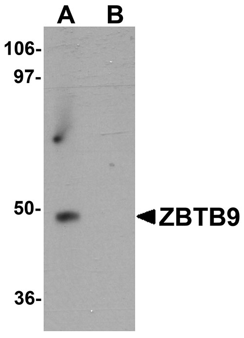1 - ZBTB9 Antibody ASC11266